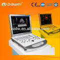 Doppler Doppler Doppler ultrason Doppler DW-C60PLUS